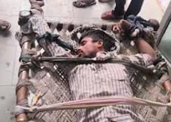 युवक को कुत्ते के काटने के बाद रेबीज का हुआ असर, रसियों से बांधा, मौत, वीडियो