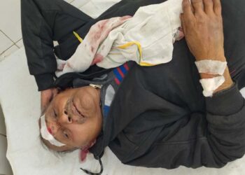अयोध्या: अधेड़ ने ट्रेन से टकराकर किया आत्महत्या का प्रयास, हालत गम्भीर