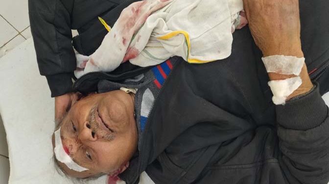 अयोध्या: अधेड़ ने ट्रेन से टकराकर किया आत्महत्या का प्रयास, हालत गम्भीर