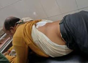 गोरखपुर में भाजपा नेता को बदमाशों ने सरेआम मारी गोली