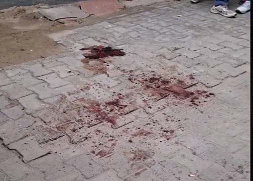 गाजियाबाद में जन्मदिन की पार्टी में ले जाने के बहाने बुलाकर दोस्तों ने की युवक की हत्या